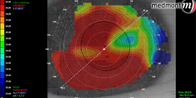 Eyecare Associates technology image